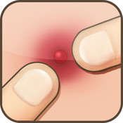 Pimple Popper Lite v6.0